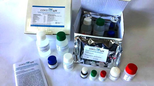 Aprobaron un nuevo test serológico nacional y un protocolo para medir anticuerpos en plasma