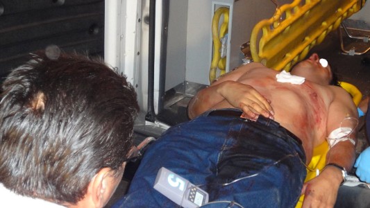 Su expareja lo apuñaló en el pecho y terminó internado