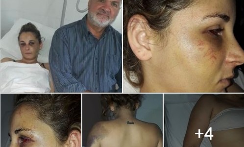 San Carlos Centro: Brutal golpiza de un hombre a su pareja