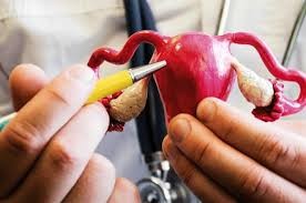 Más de 2.000 mujeres mueren por cáncer de cuello de útero causado por el VPH cada año en Argentina