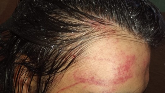 Golpiza de odio: atacaron en patota a trans de 16 años a la salida de una fiesta