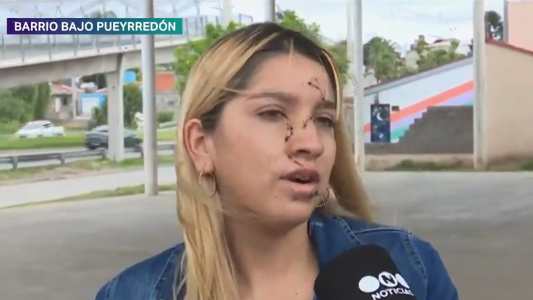 Habló Melisa, la chica cortada con un vidrio en una fiesta. Hay una agresora detenida