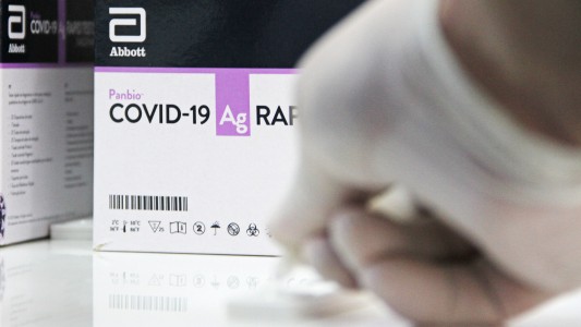 Covid-19: la provincia brindó recomendaciones para el uso de test de antígenos