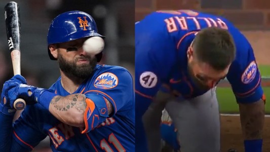 Beibolista recibió un pelotazo en la cara a 150 km/h y terminó en el hospital