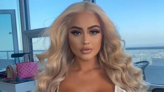 Una joven influencer terminó con los glúteos "arruinados" tras gastar 8.000 euros en inyecciones