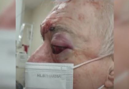 Un jubilado defendió a su familia y terminó baleado en la cara