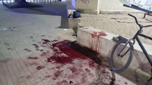 Motochorros balearon a joven en la plaza de Alberdi y Génova