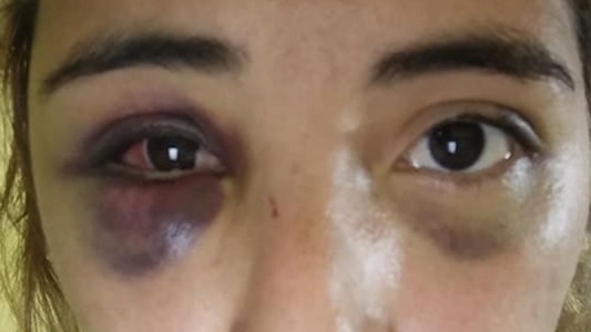 Sobrevivió a una brutal paliza de su ex pareja, que permanece prófugo