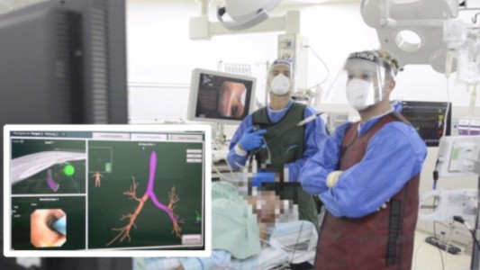 Investigadores israelíes desarrollaron un método de inteligencia artificial para eliminar tumores cancerosos