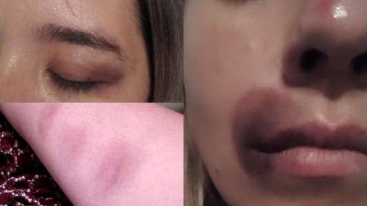 Ataque de odio: brutal golpiza a ex candidata a jefa comunal de la región