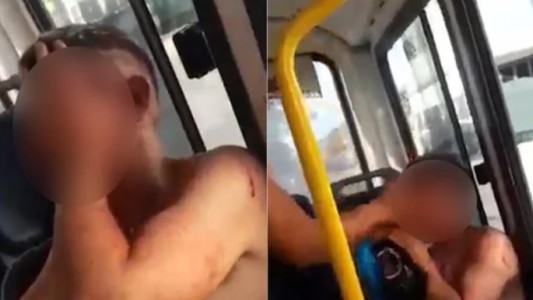 "Andá a laburar como nosotros": sorprendieron a un menor robando y le pegaron hasta dejarlo sangrando