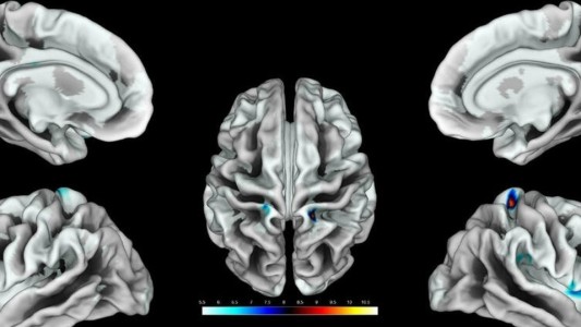 Fin del misterio: científicos identificaron el área del cerebro que corresponde al clítoris