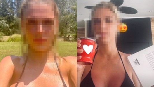 La nueva cara de Viviana Canosa: ¿lifting o filtro de Instagram?