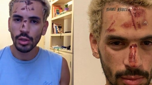 Brutal paliza a un joven por ser gay en un boliche