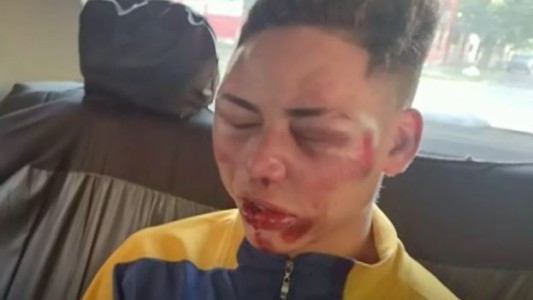 Video: lo desfiguraron por una gorra a la salida de un boliche