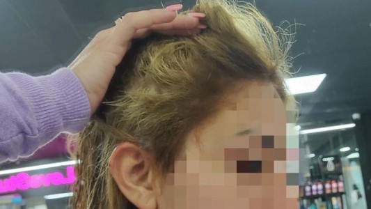 Fue a la peluquería para un cambio de look y se le cayó el pelo: le ofrecieron una peluca como consuelo