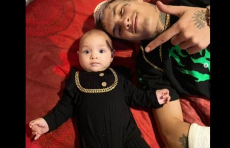 L-Gante se lesionó el brazo derecho