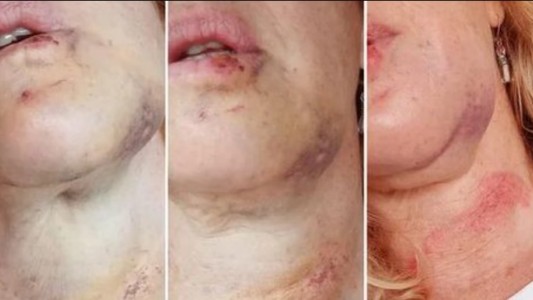 Alarma por un hombre que agrede a mujeres en las calles de Belgrano R.