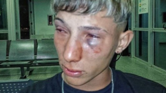 Patovicas le dieron una brutal golpiza a un joven en un boliche de Santo Tomé