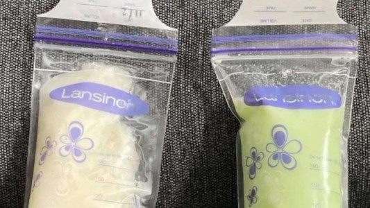 ¿Leche verde? El extraño síntoma que padecen algunas madres lactantes luego de contagiarse con Ómicron