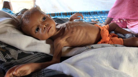 Con 3 años y 4 kilos, una niña al filo de la muerte