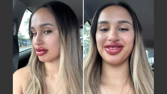 Recibió un canje para tatuarse los labios pero no tuvo el resultado esperado