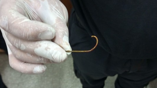 Un pescador torpe se clavó un anzuelo en la nariz y terminó en el hospital