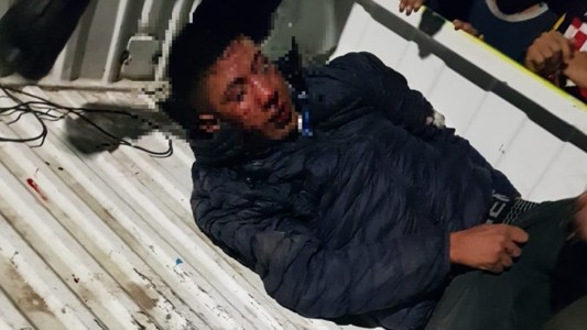 Hartos de la inseguridad, vecinos lincharon y le amputaron dos dedos a un ladrón