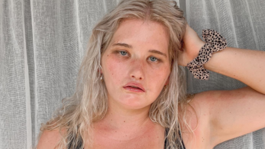 Sufre un extraño síndrome que no le permite sonreír y ahora trabaja de modelo