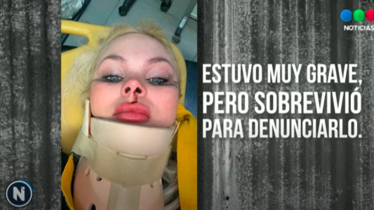 El calvario de una modelo: su ex pareja la intentó matar con su camioneta y ahora está prófugo