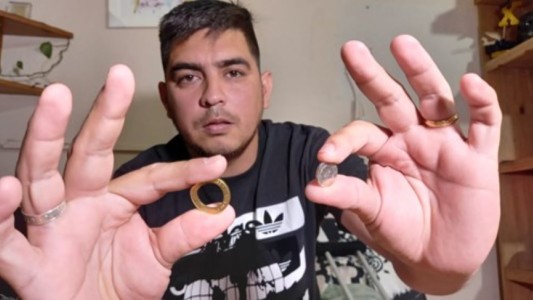 Córdoba: un ladrón le disparó y se salvó gracias a una moneda de $2