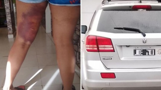 Tras un choque, dos mujeres se agarraron de los pelos y una atropelló a la otra