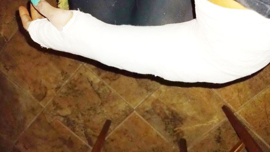 Un grupo de perros atacó a una motociclista y terminó con una fractura