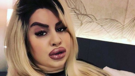 Se hizo 5 cirugías, gastó 150.000 dólares para tener la cola más grande del mundo y la rompe en OnlyFans