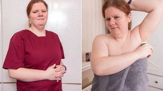 La mujer que huele permanentemente a pescado contó su historia