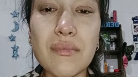 El drama de una madre que necesita de todos para salvar a su beba por nacer