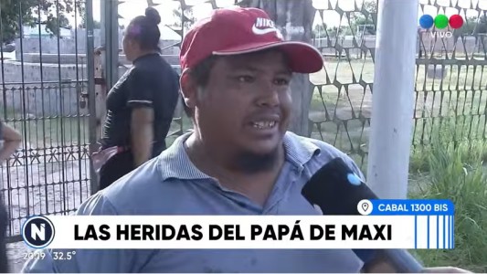 El papá del nene asesinado, entre heridas por balas de goma y temor a represalias