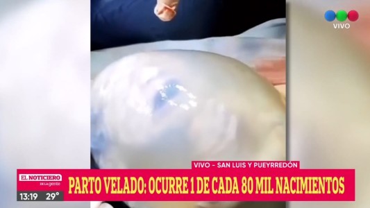 Parto velado en Rosario: ocurre uno cada 80 mil nacimientos