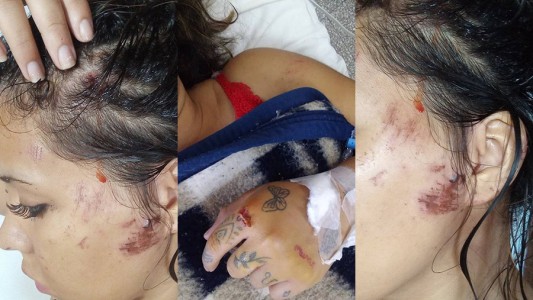 Video: atropelló a una chica a la salida de un boliche y huyó