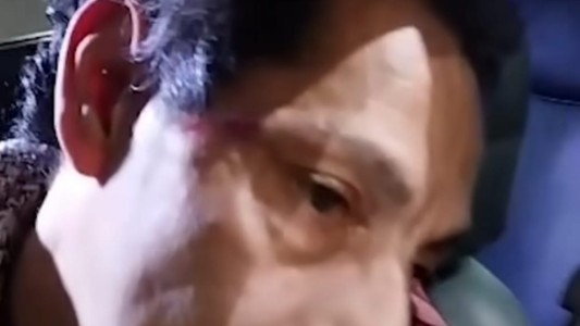 Un taxista fue violentamente atacado por sus colegas en la Terminal de Ómnibus