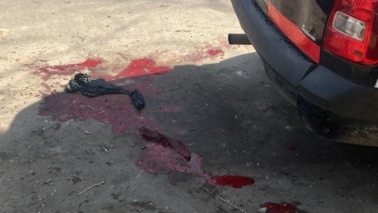 Un Pitbull atacó ferozmente a varias personas y fue baleado por un policía