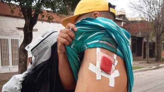 Habló la abuela de uno de los heridos de la balacera en Tablada