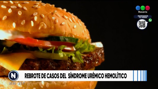 Crecen los casos de Síndrome Urémico Hemolítico en el país