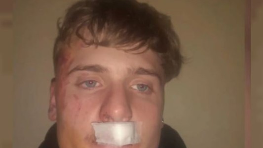 Un joven recibió una brutal golpiza por parte de rugbiers en Zárate: “Pudo ser como Fernando Báez Sosa”