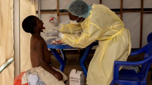 La OMS declaró a la viruela del mono como nueva emergencia de salud pública internacional