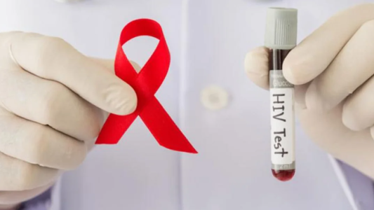 Condenaron a un hombre por contagiar con HIV a su pareja