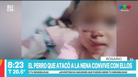 Un perro atacó a una nena de 2 años y ahora buscan darlo en adopción