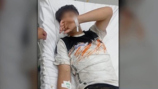 Recibió un palazo durante un partido y mientras se recupera, su familia busca al agresor