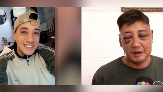 Salió de un cumpleaños de 15, lo asaltaron y golpearon brutalmente