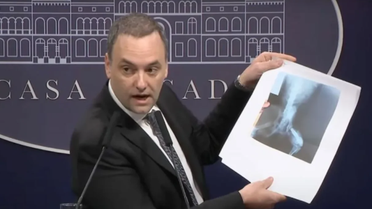 Por irregularidades, el Gobierno comienza a auditar más de un millón de pensiones de Anses por invalidez